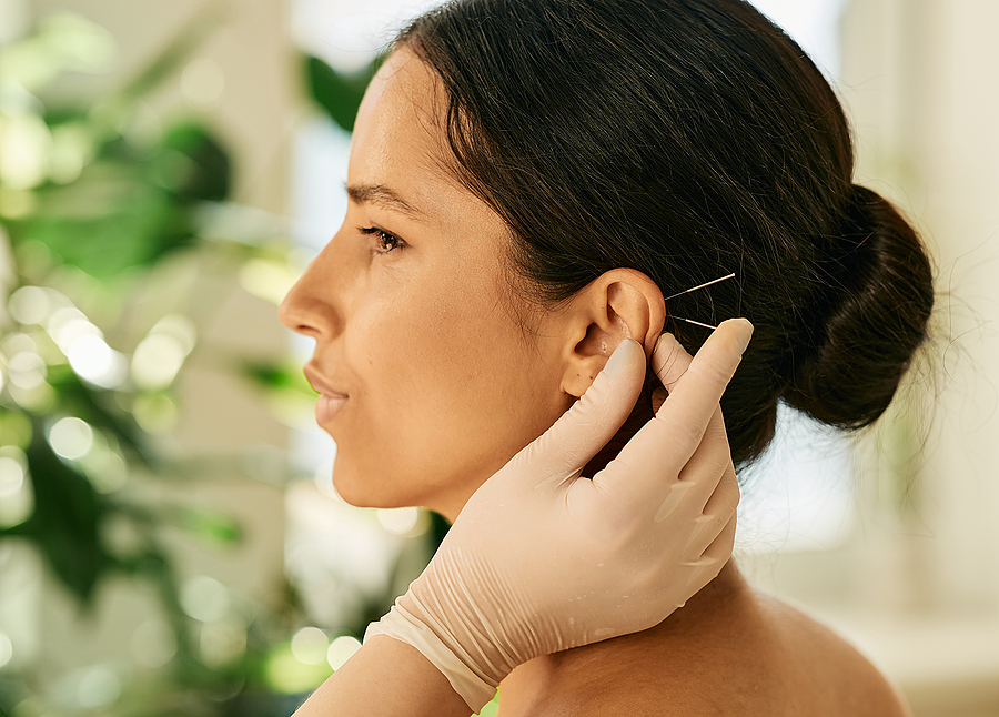 Ear Acupuncture Treatment Can Assist in Increasing Weight Loss - Here's How by Acupuncture Associates of America 505-275-9602